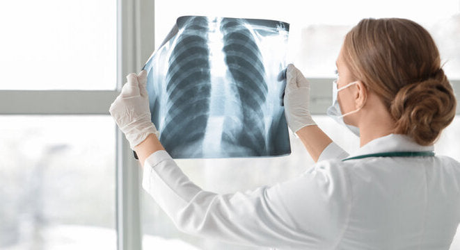 Chronic obstructive pulmonary disease (COPD)